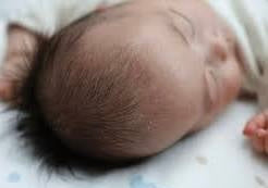 Flake-Free Baby Scalp Oil