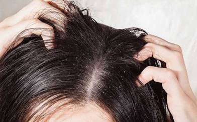 Comfort & Calm Soothing Scalp Oil