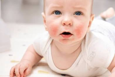 Baby Soothe Eczema Relief Oil