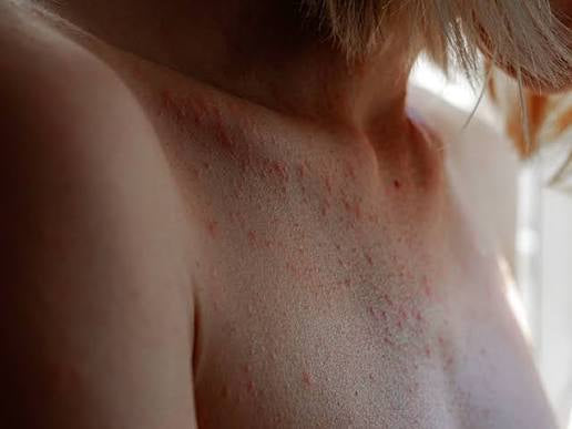 Calm the Hive Body Oil