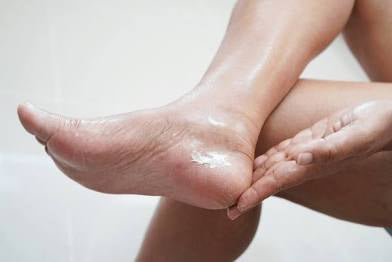Soothing Foot Balm